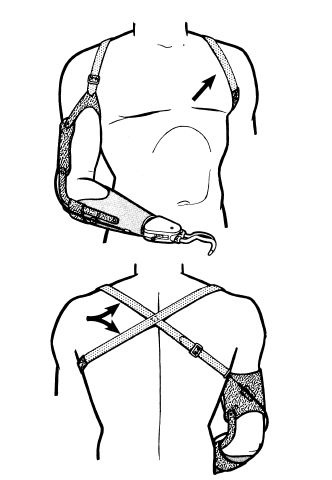 icd 10 code for enlarged right paratracheal lymph node