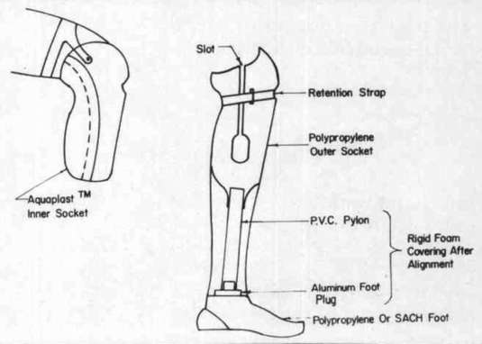 Fig. 1. Line Drawing Of The Preparatory B/K Pr | O&P Digital Resource ...