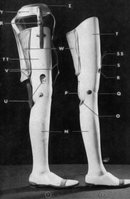 Legend: N. Shank (Shin), O. Knee extension stop, P | O&P Digital