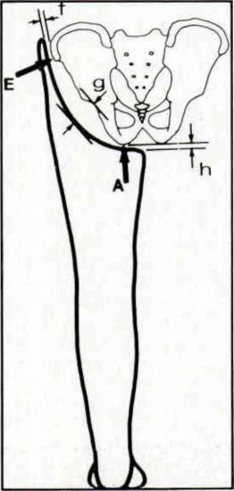 Figure 11. Transverse Cross-section Of Part Of | O&P Digital Resource ...