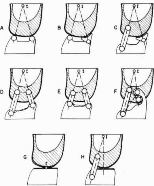 Figure 4. Polycentric Knee Mechanisms. | O&P Digital Resource Library