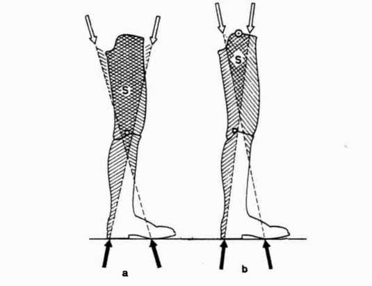 Fig. 8. Stability Diagram (after Radcliffe), A | O&P Digital Resource ...