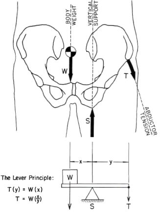 Fig. 3. Lever action of the pelvis in stabilizatio | O&P Digital ...