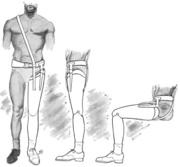Fig. 1. Saucer-type prosthesis for hip disarti | O&P Digital Resource ...