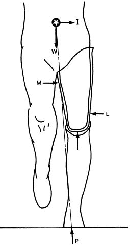 Fig 19B-1. During single-limb stance on the pr | O&P Digital Resource ...