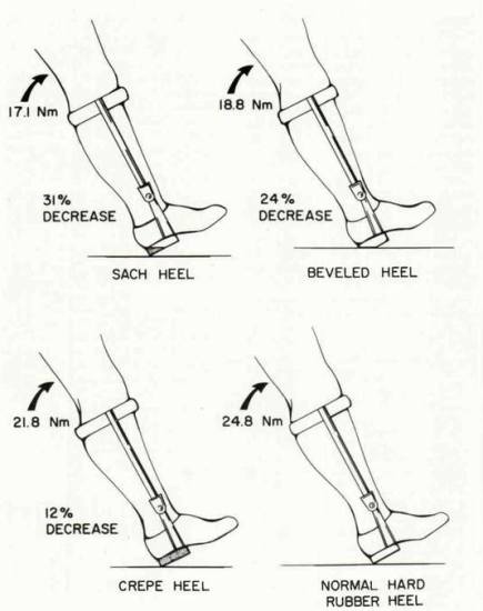 Figure 4. Loading response knee flexion torque | O&P Digital Resource ...