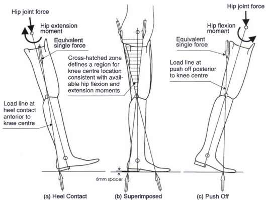 Fig. 4. Stability diagram - single axis prosth | O&P Digital Resource ...