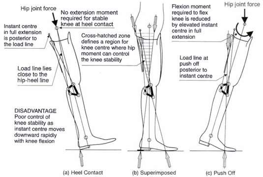 Fig. 5. Stability diagram - four-bar knee with | O&P Digital Resource ...